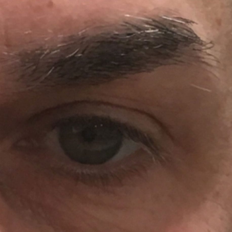 Eye enhancement after